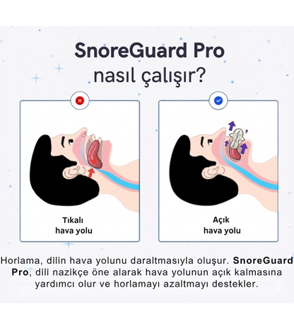 SleepMate SnoreGuard Pro™ | Horlama Önleyici Dil Aparatı